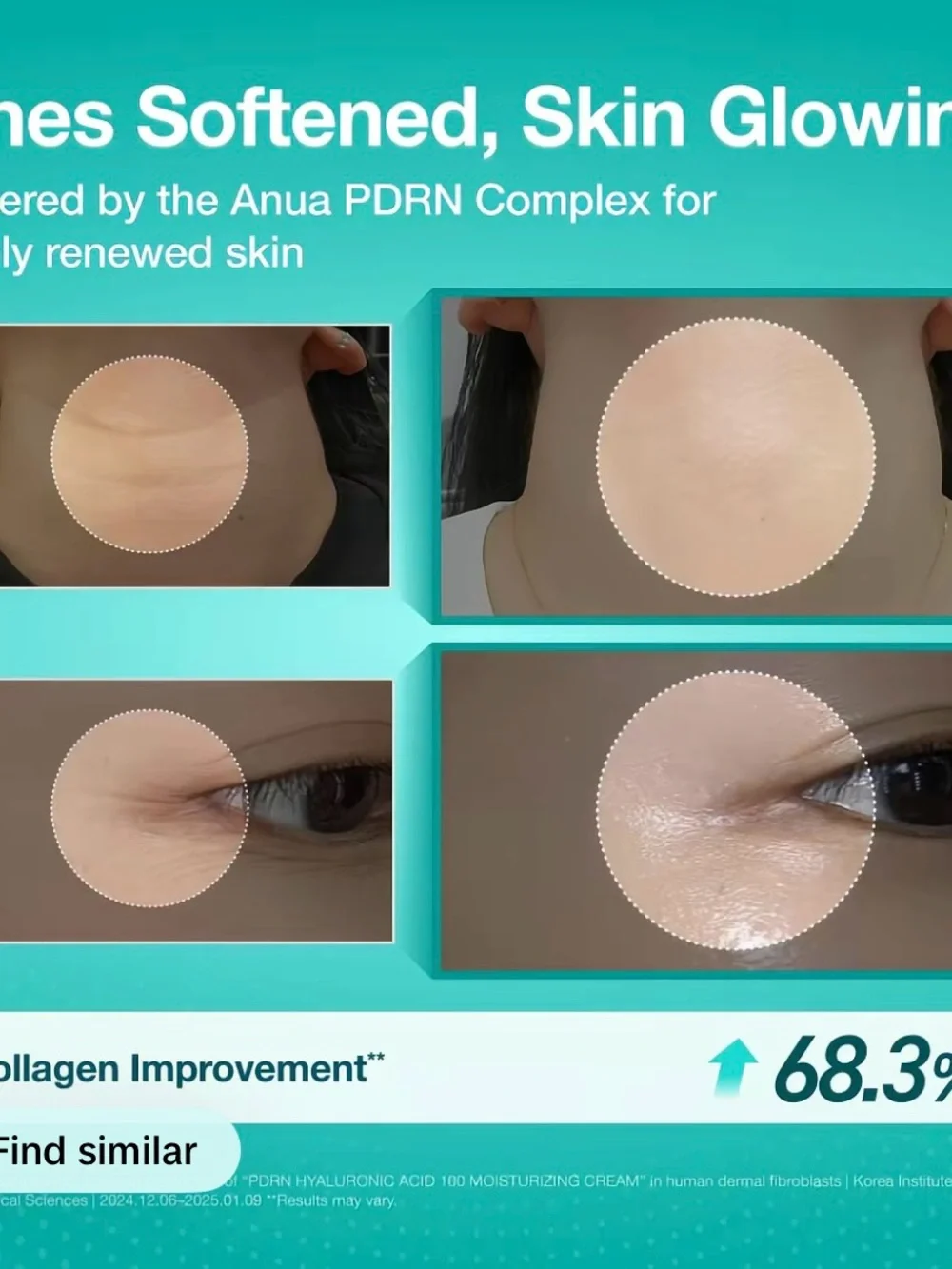 Anua 100+ PDRN + Hyaluron Moisturizing Cream — White/Bronze